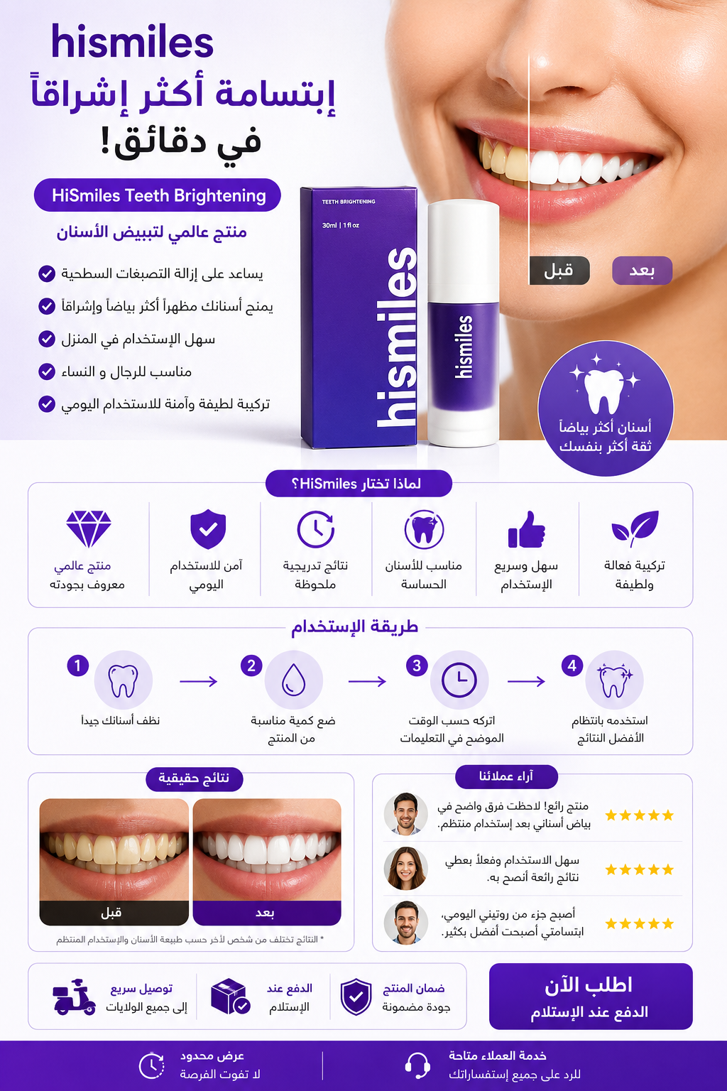 💜 HiSmiles لتبييض الأسنان جودة امريكية