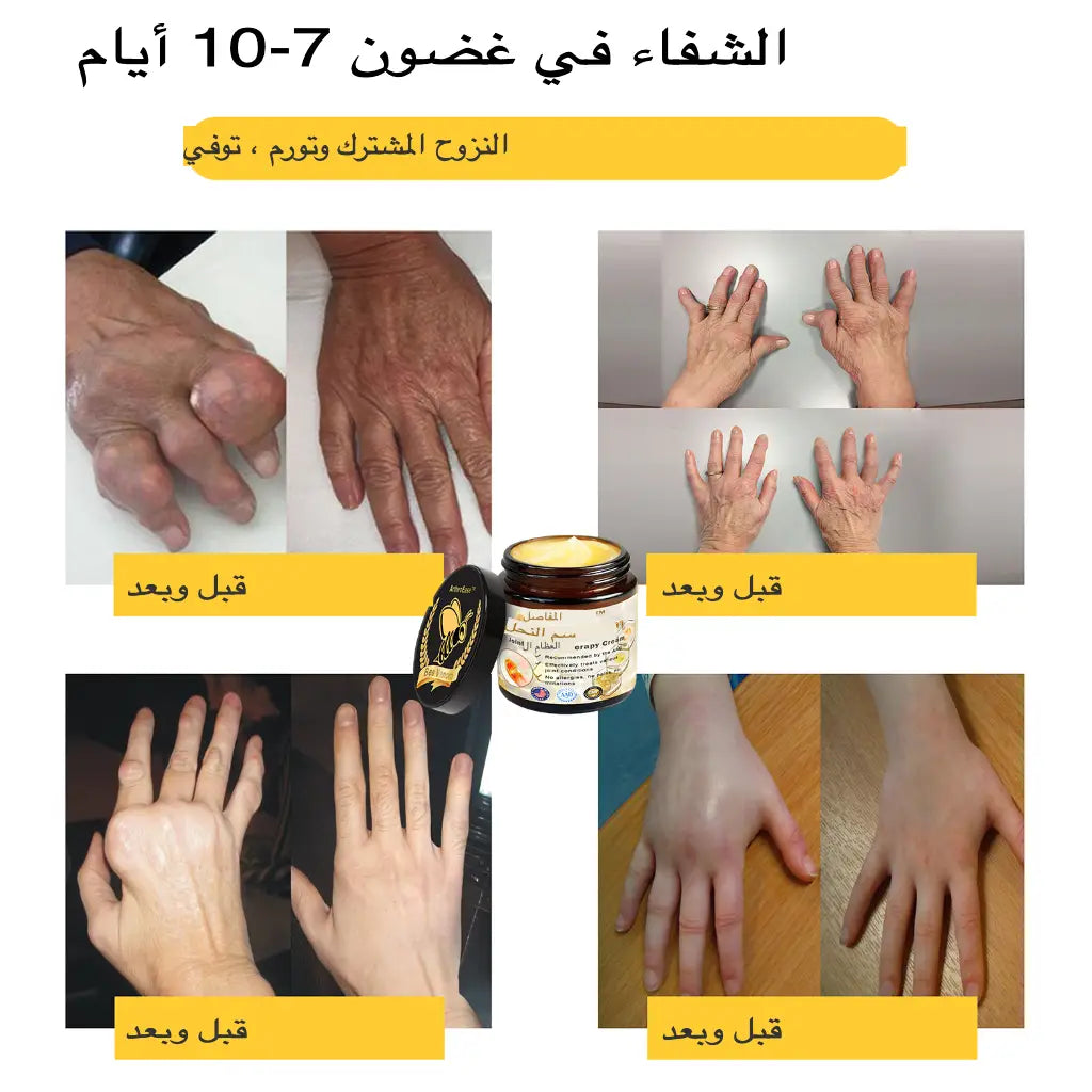 كريم سم النحل BEE VENOM الاصلي اشتري علبتين و استفد من ثالثة مجانا ب 2900دج فقط