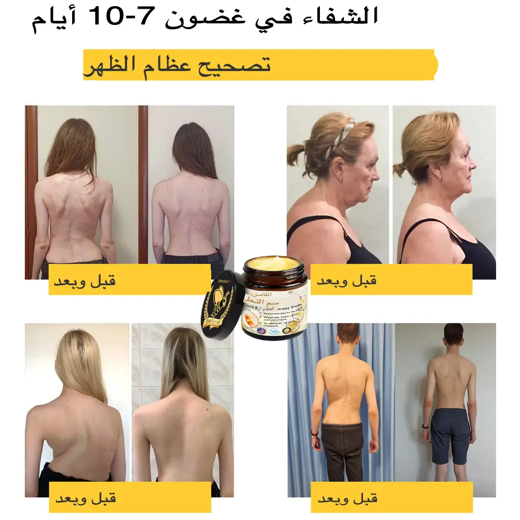 كريم سم النحل BEE VENOM الاصلي اشتري علبتين و استفد من ثالثة مجانا ب 2900دج فقط